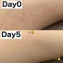 日本制小林制药 手臂背部鸡皮膏