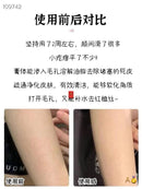 日本制小林制药 手臂背部鸡皮膏