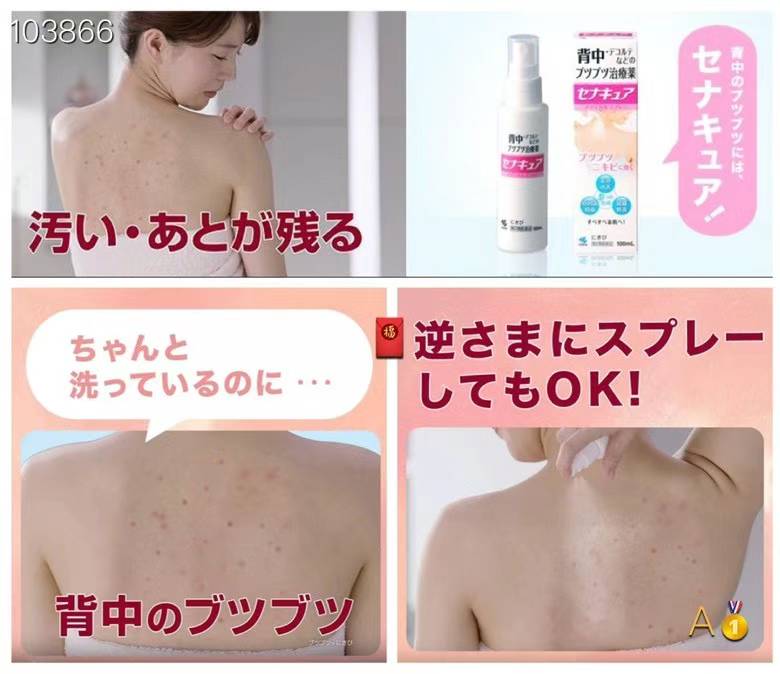 Kobayashi back acne spray
